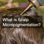 What is Scalp Micropigmentation?